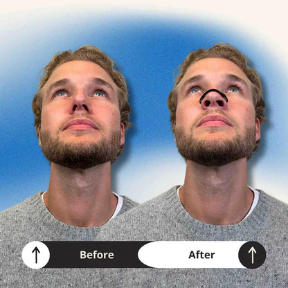 🌙 Magnetic Anti-Snoring Nose Clip & Strip – Reusable Nasal Breathing Aid