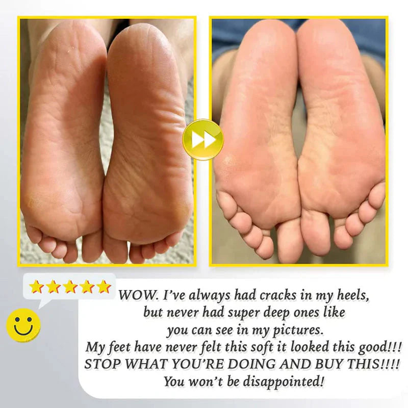Rechargeable electric foot file for calluses Two speeds and removable grinding head USB charging Available