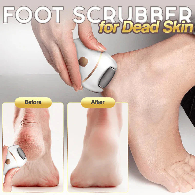 Rechargeable electric foot file for calluses Two speeds and removable grinding head USB charging Available