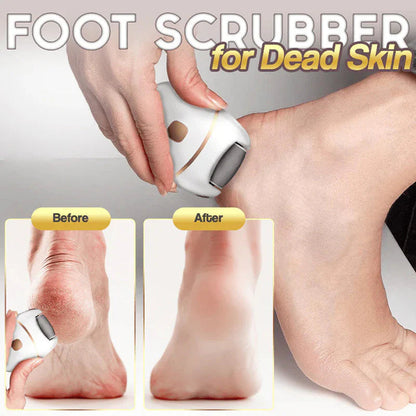 Rechargeable electric foot file for calluses Two speeds and removable grinding head USB charging Available
