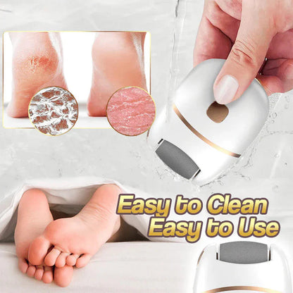 Rechargeable electric foot file for calluses Two speeds and removable grinding head USB charging Available