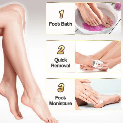 Rechargeable electric foot file for calluses Two speeds and removable grinding head USB charging Available