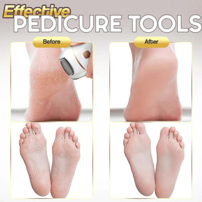 Rechargeable electric foot file for calluses Two speeds and removable grinding head USB charging Available
