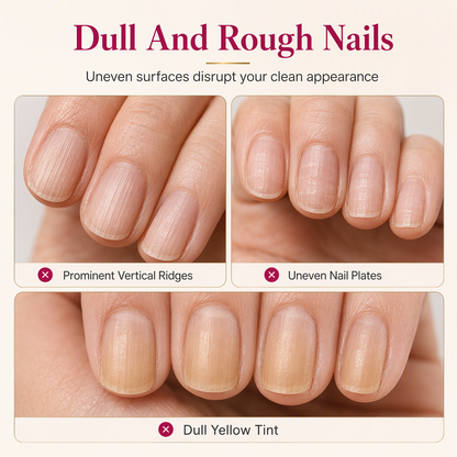 🔥Smooth Nail Ridges Instantly! Natural Ridge Filler
